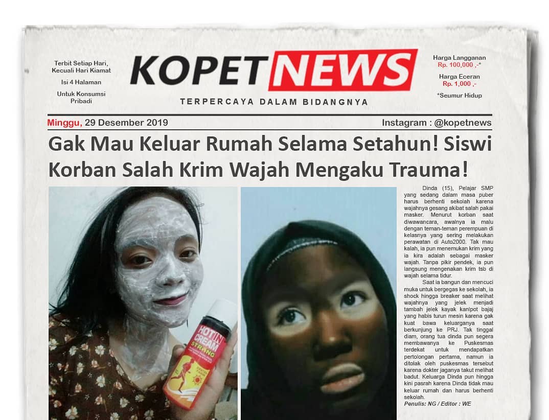 Gak Mau Keluar Rumah Selama Setahun! Siswi Korban Salah Krim Wajah Mengaku Trauma!